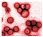 Influenza Virus